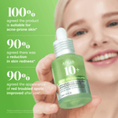 Azelaic Acid 10 Hyaluron Redness Soothing Serum 30ml